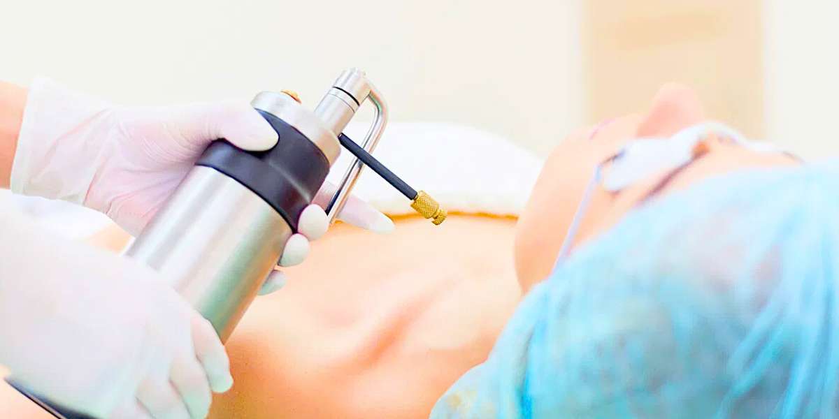 Crioterapia e Criocirurgia