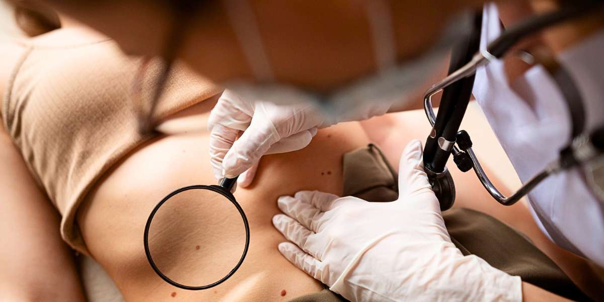 Dermatoscopia e Mapeamento Corporal