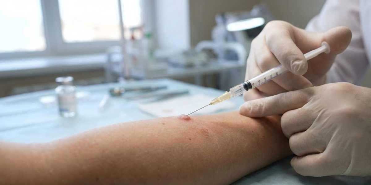 Infiltrações Intra-lesionais