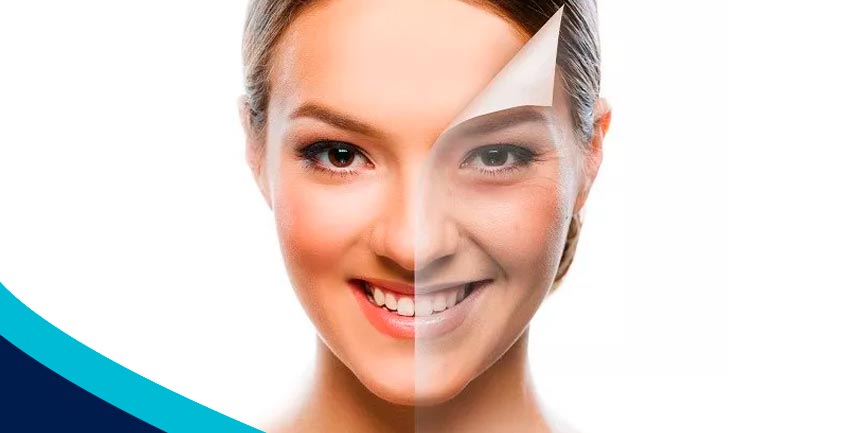 Quais os benefícios do Peeling?