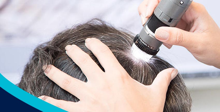 Vitaminas e alopecia