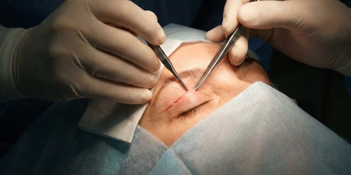 Blefaroplastia: Redescubra o Poder do Seu Olhar