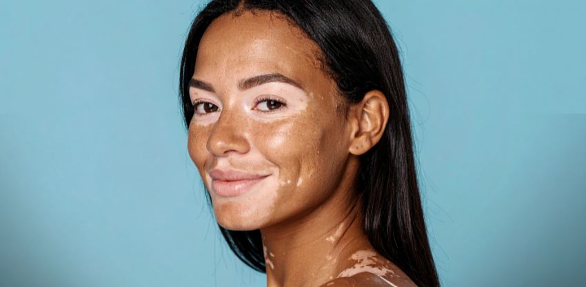 O Estresse Imprime Sinais na Sua Pele?