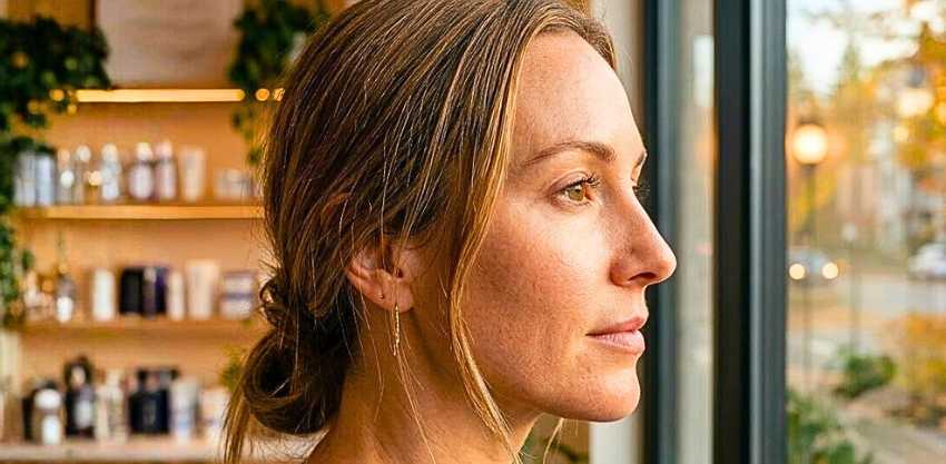 O verão acabou e as manchas ficaram? Saiba por que tratar o melasma no outono